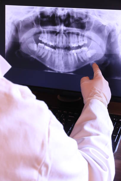 Best Emergency Root Canal Treatment in Caseyvle, IL